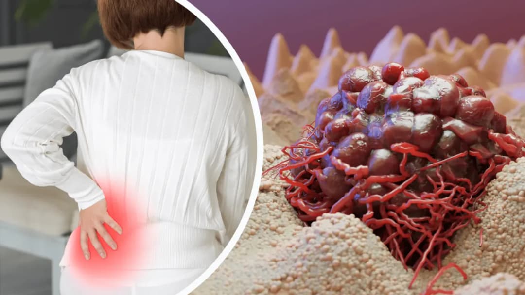 Zwolnienie na kręgosłup (L4) - Jak załatwić L4 na kręgosłup