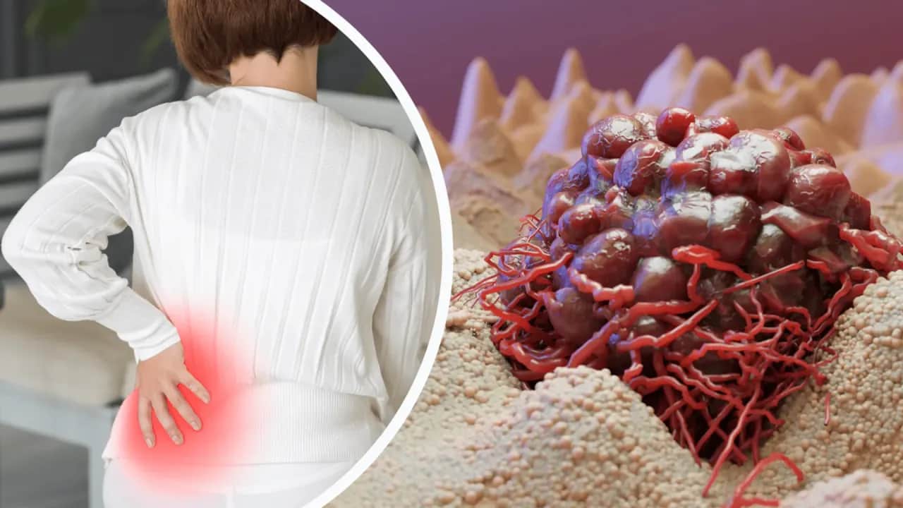 Zwolnienie na kręgosłup (L4) - Jak załatwić L4 na kręgosłup